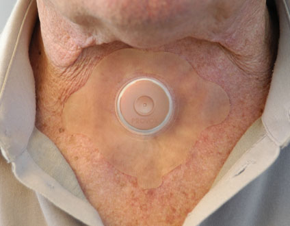 ウェブファクトリー　Atos 気管孔プロテクター・エプロン 2025年最新】Atos Medical Japan 看護・介護用品の人気アイテム